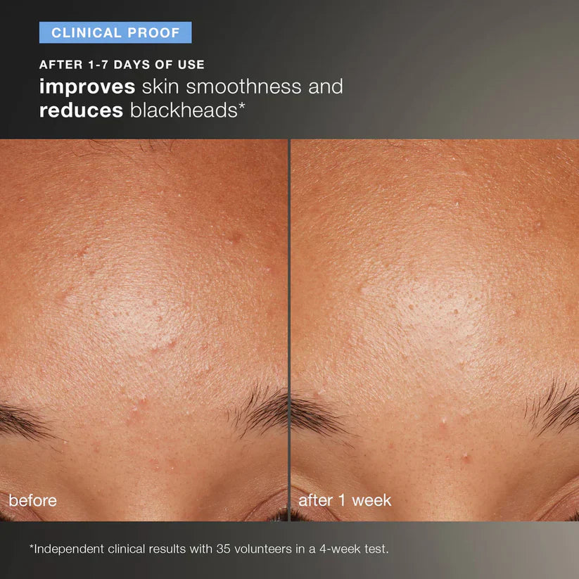 Daily Microfoliant Exfoliator