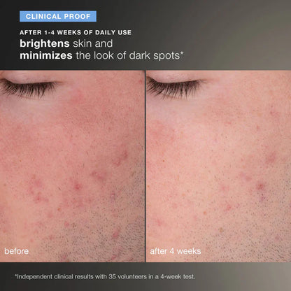 Daily Microfoliant Exfoliator