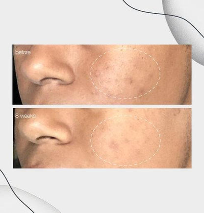 PowerBright Dark Spot Serum