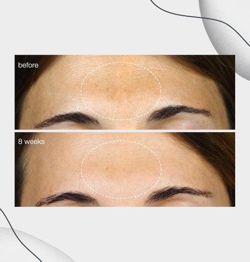 PowerBright Dark Spot Serum