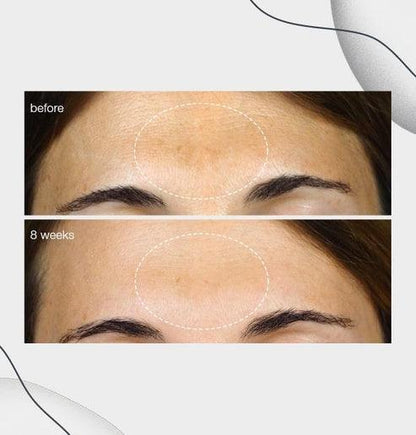 PowerBright Dark Spot Serum